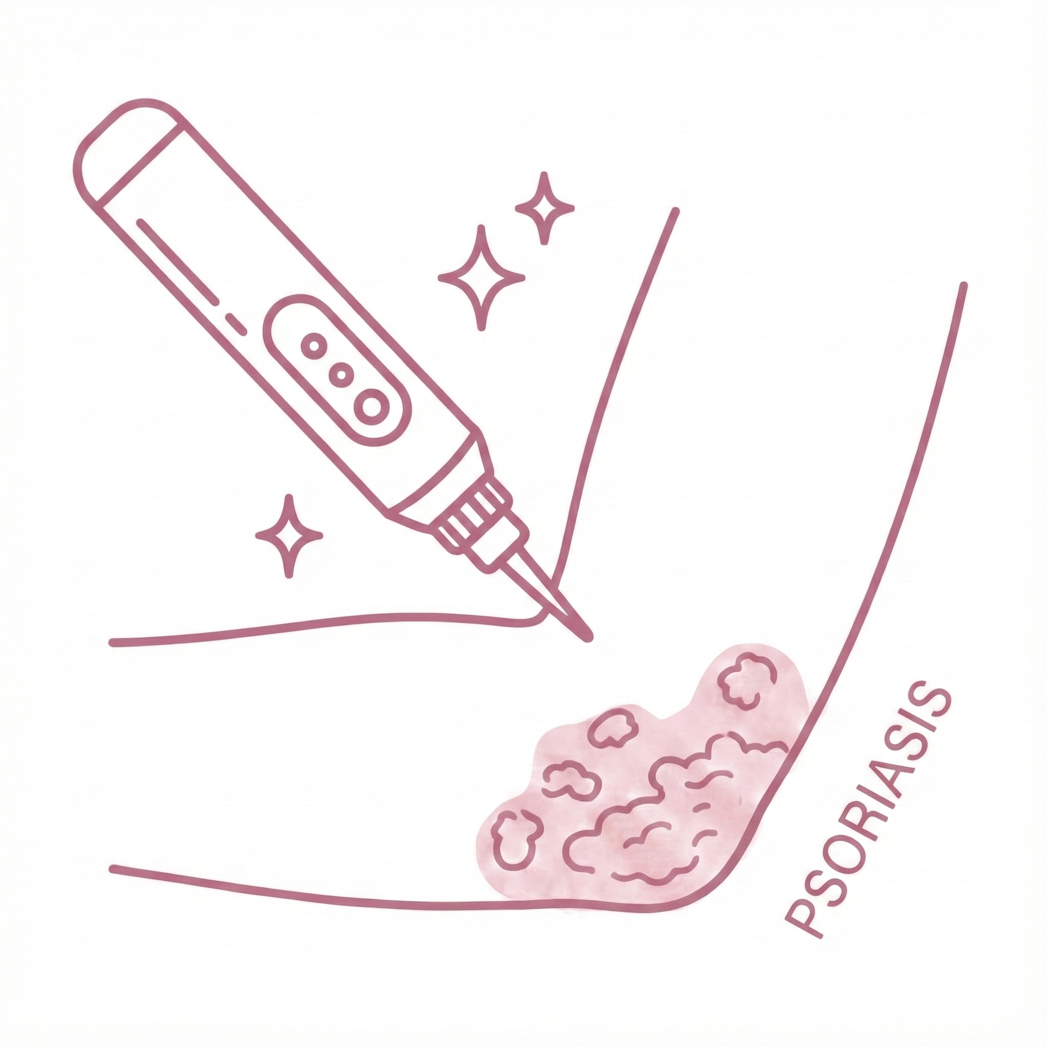 PLASMA FOR PSORIASIS